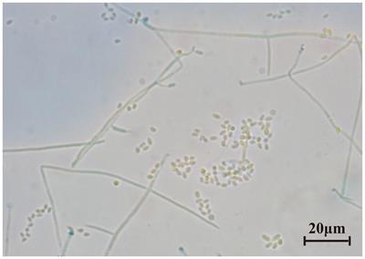 Positive effects of Cordyceps cateniannulata colonization in tobacco: Growth promotion and resistance to abiotic stress